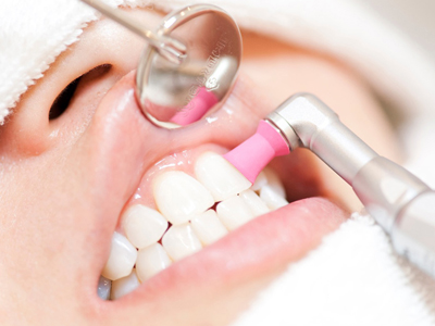 練馬区の予防歯科